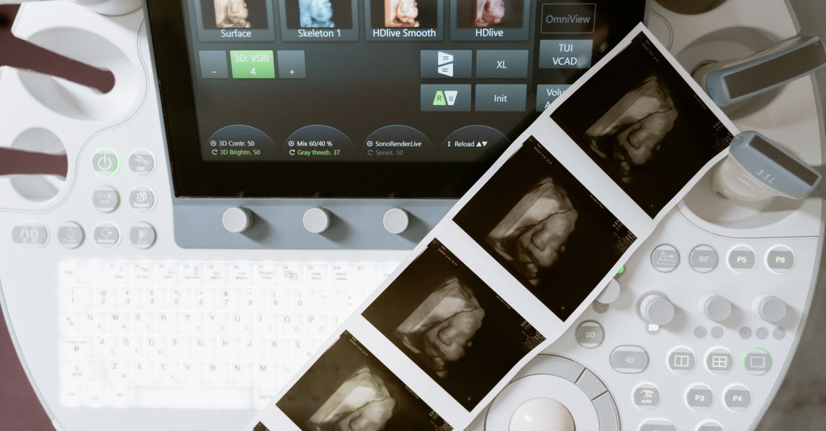 Midjourney scanner ecografo